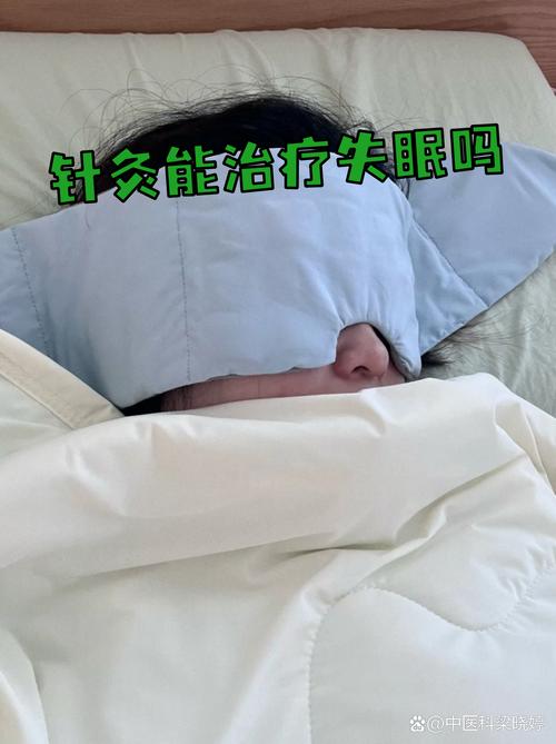 针灸治疗失眠效果如何