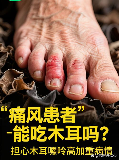 痛风能吃木耳和青椒吗