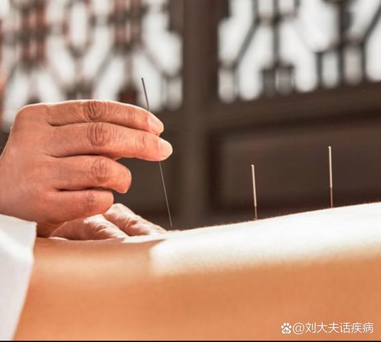 针灸图片高清图片大全