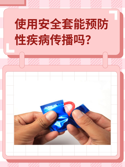 用安全套会得妇科病吗