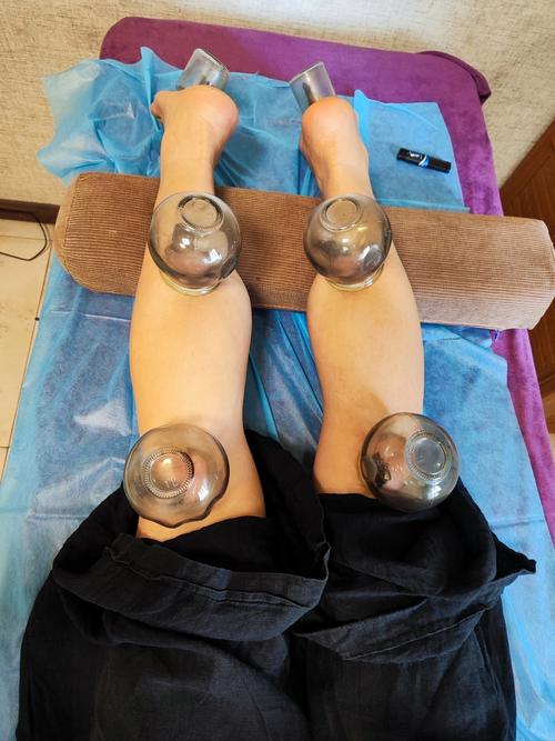 盆腔囊肿可以针灸吗