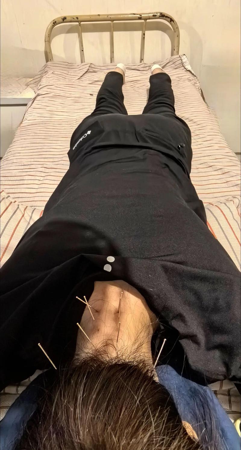 咽炎充血用针灸行吗