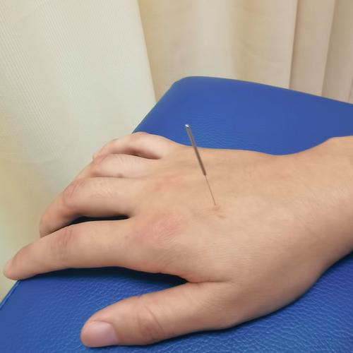 针灸真可以治疗腰痛