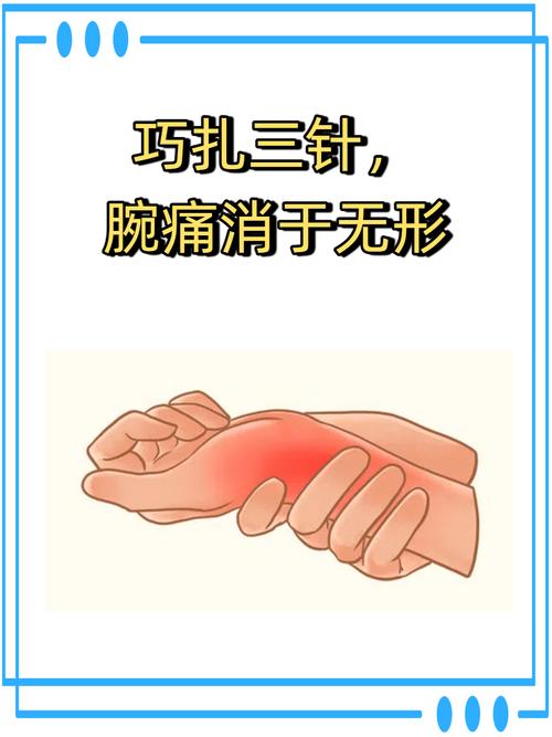 针灸注意那里不能针