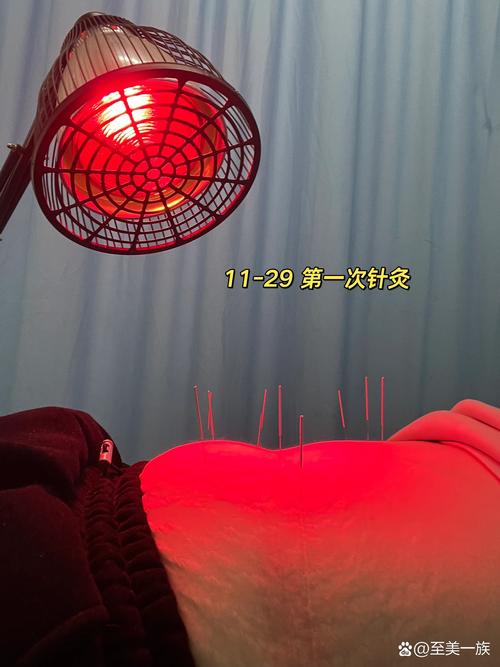 针灸减肥后不来月经