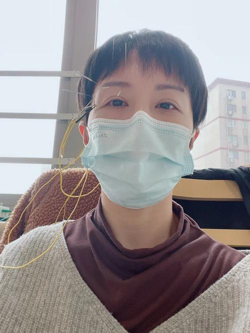 眼睑痉挛针灸能好吗