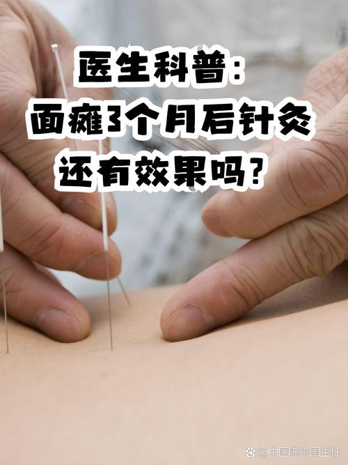 面瘫好了还要针灸吗