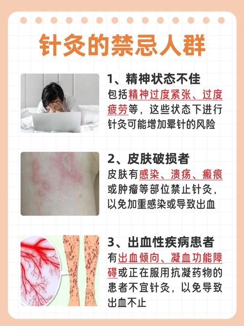 针灸完了还要打针吗