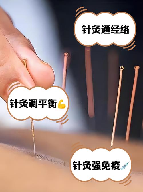 针灸妇科多久有效果