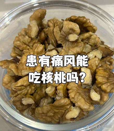 痛风的人可以吃核桃吗
