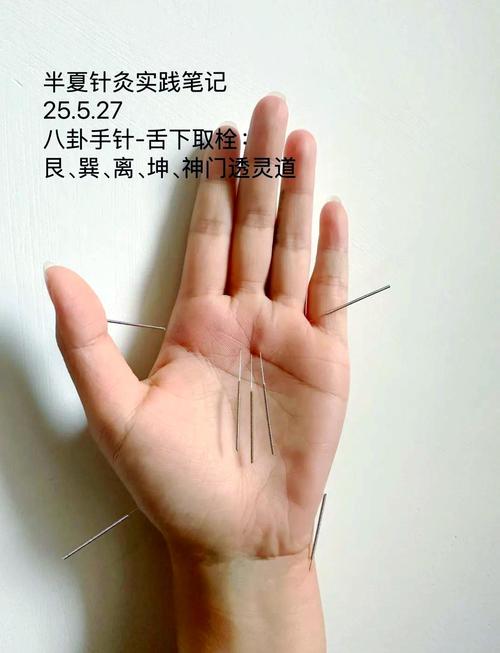 手上针灸有没有危险