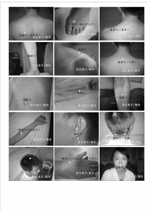 宝鸡针灸王怎么收费