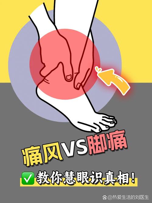 脚上痛风是怎么引起的