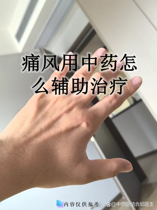 沈阳那家医院治痛风好