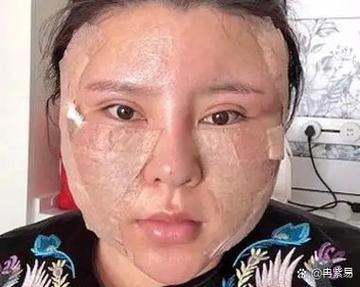 工作室打玻尿酸安全吗