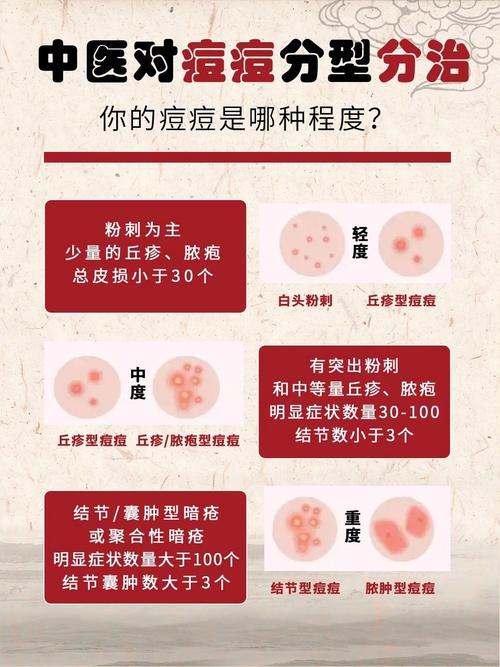 针灸痤疮治疗的时间