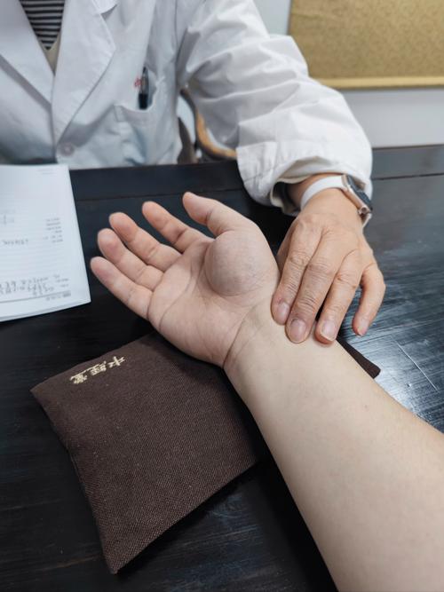 针灸治疗手指类风湿