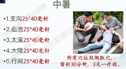 中暑针灸的治疗方法