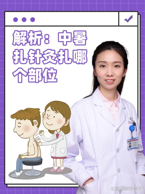 中暑针灸的治疗方法