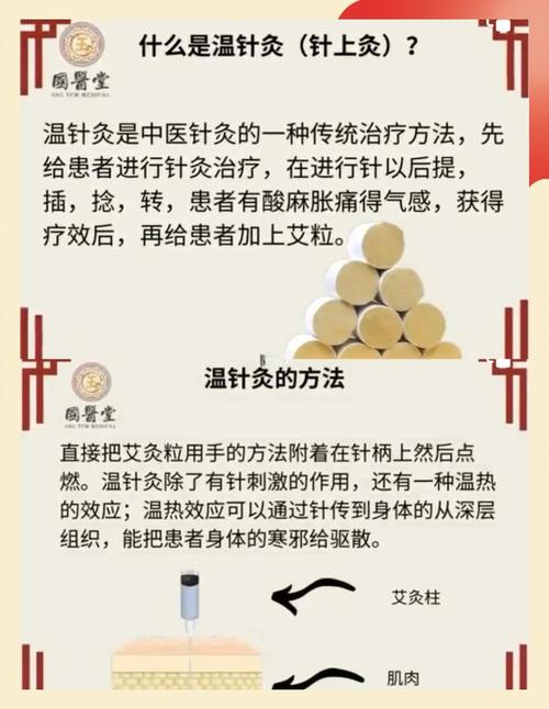 针灸作用的整体调节