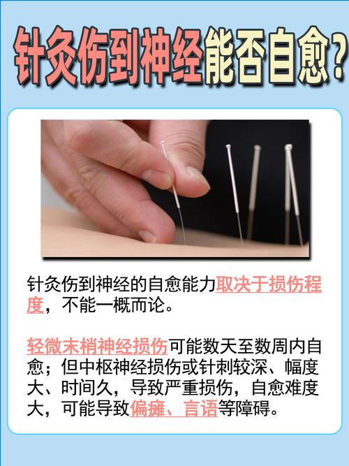 神经断了针灸管用吗