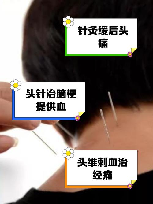 神经断了针灸管用吗