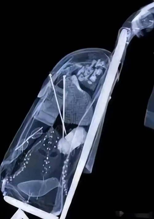 安全套过安检能看到吗