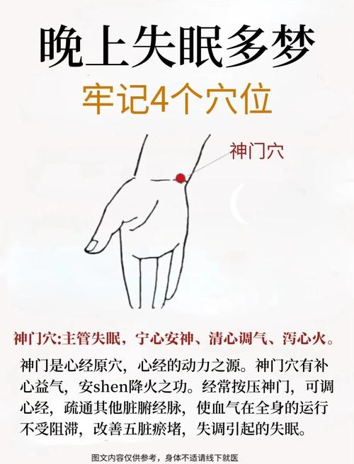 针灸治疗失眠扎哪里