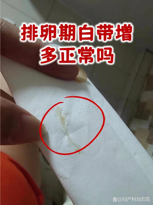 安全期有白带是排卵吗