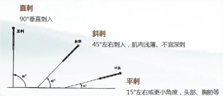 失传的中医针灸针法