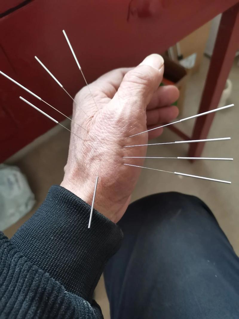 失传的中医针灸针法
