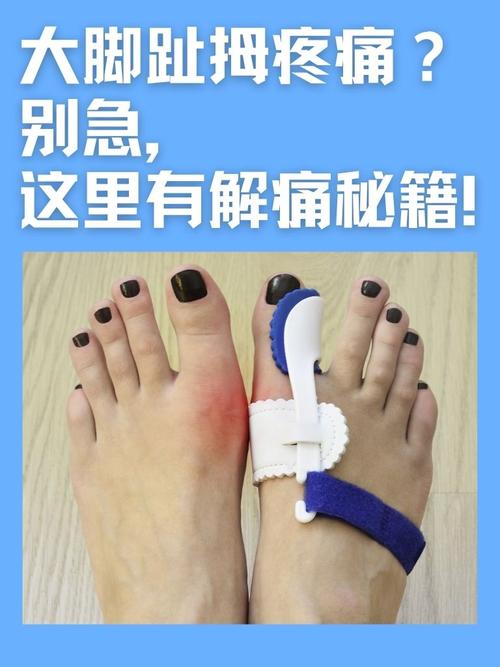 脚大拇指痛风治疗方法