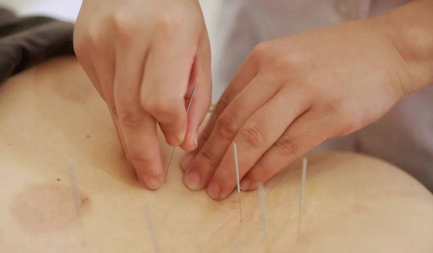 32岁想学针灸推拿