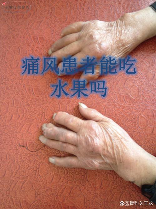 痛风患者不能吃的水果