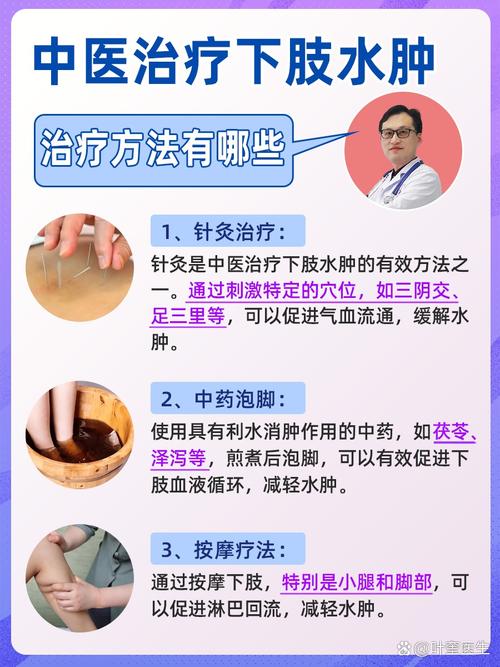 下肢水肿的针灸治疗