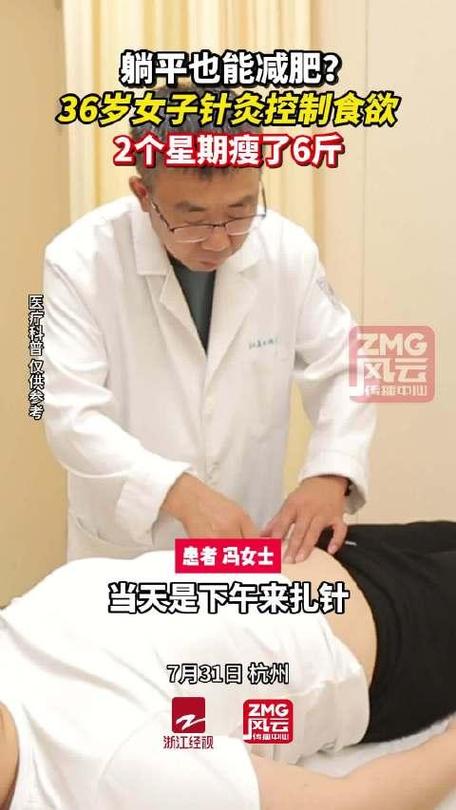 针灸减肥天天扎好吗