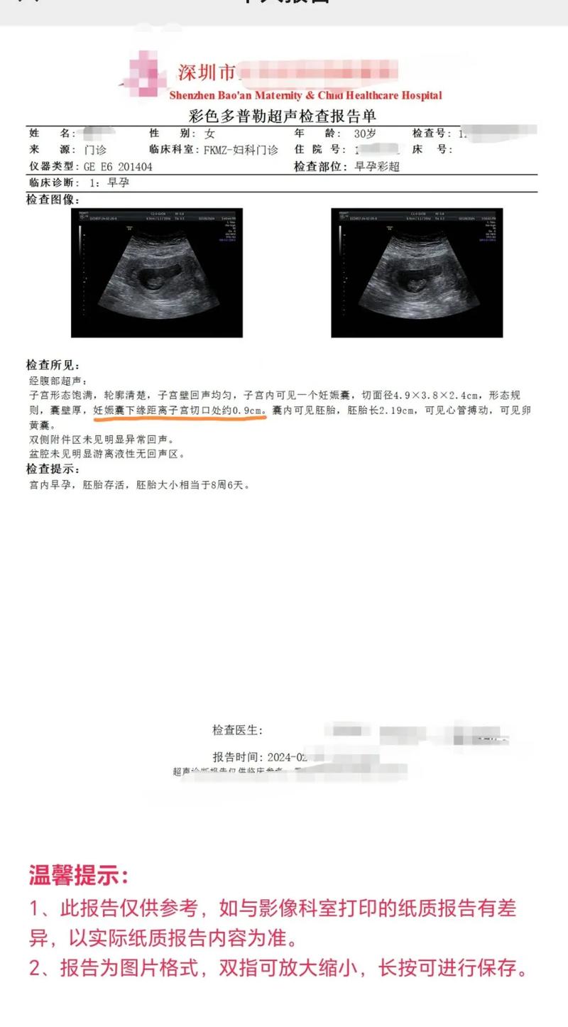 胎囊离疤痕的安全距离