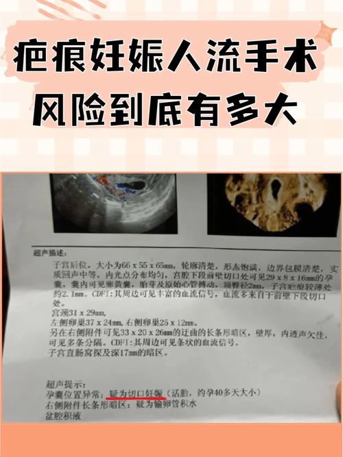 胎囊离疤痕的安全距离