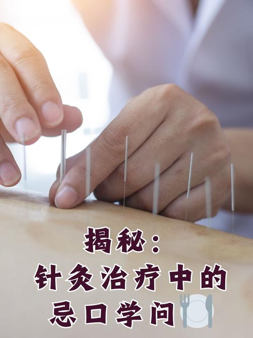 曙名中医养生 针灸