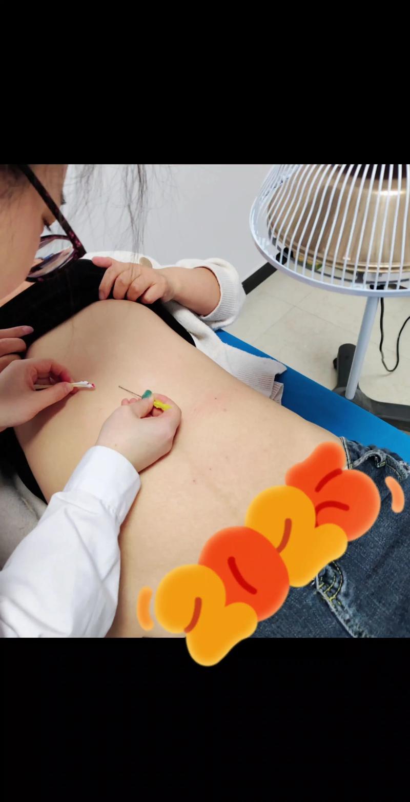 郑州那里有针灸减肥