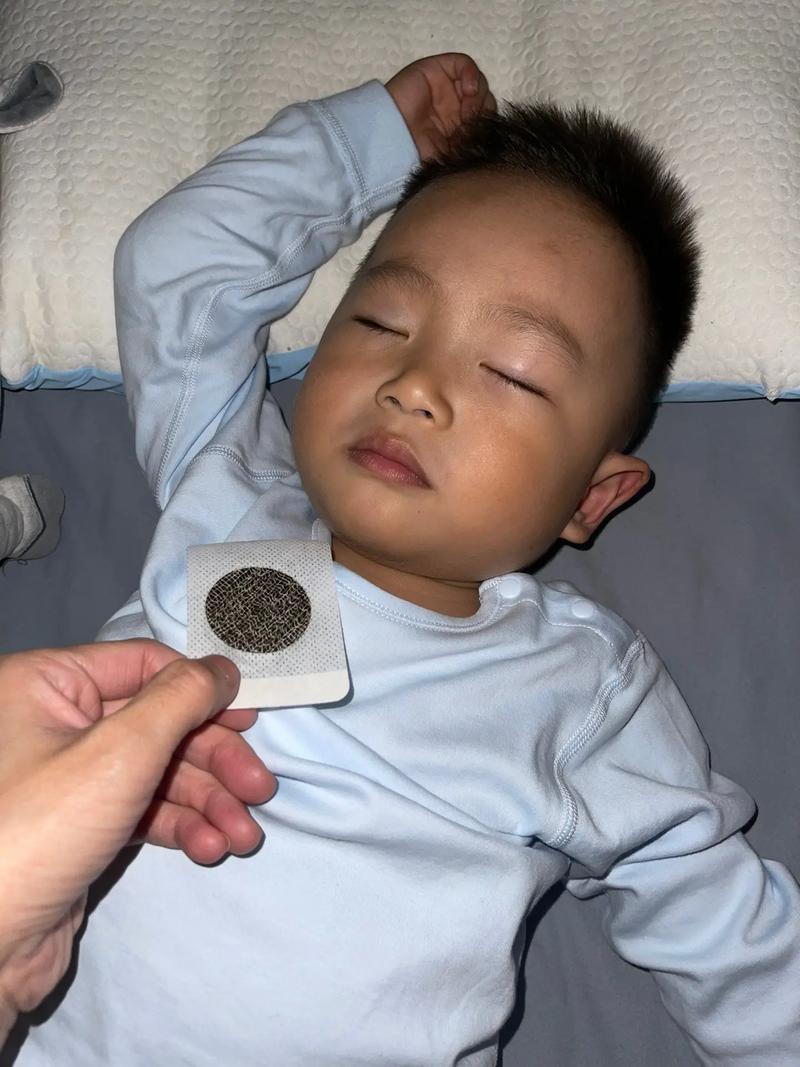 宝宝咳嗽可以针灸吗