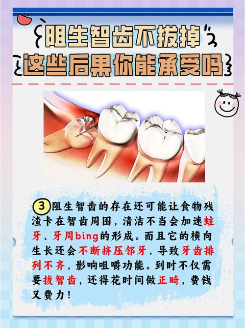 二甲医院拔智齿安全吗