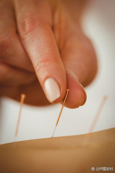 针灸过敏还能继续吗