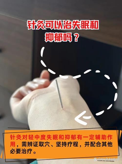 针灸完了晚上睡不着