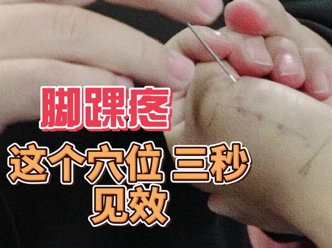 踝关节疼痛针灸图片