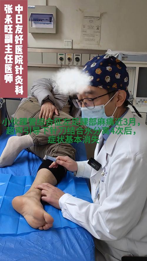 踝关节疼痛针灸图片