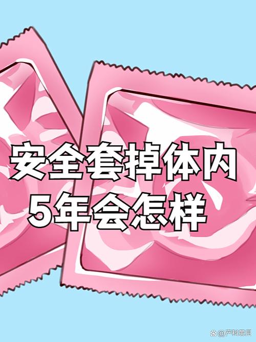 安全套会不会掉在体内