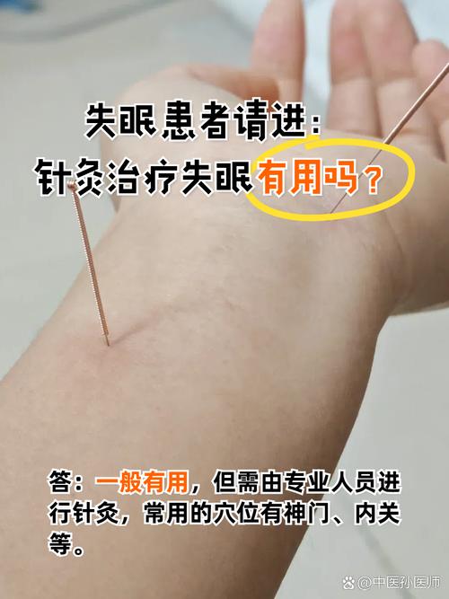 长期失眠针灸有效吗