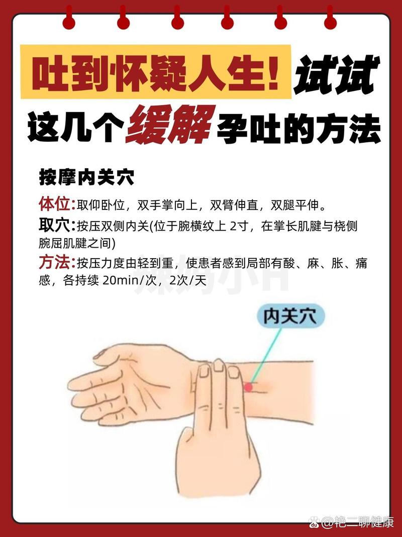 孕吐严重可以针灸吗