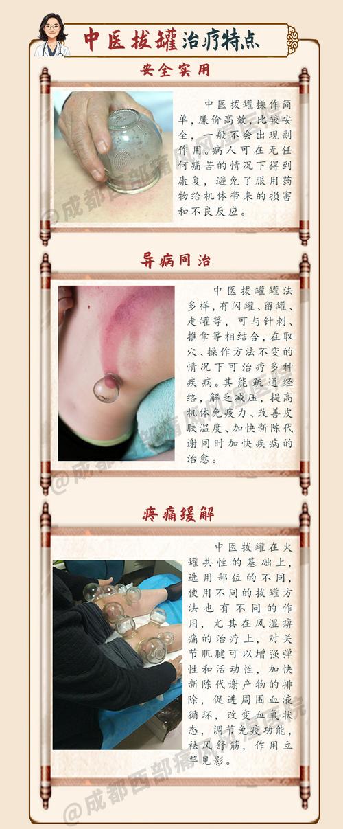 痛风可以针灸拔火罐